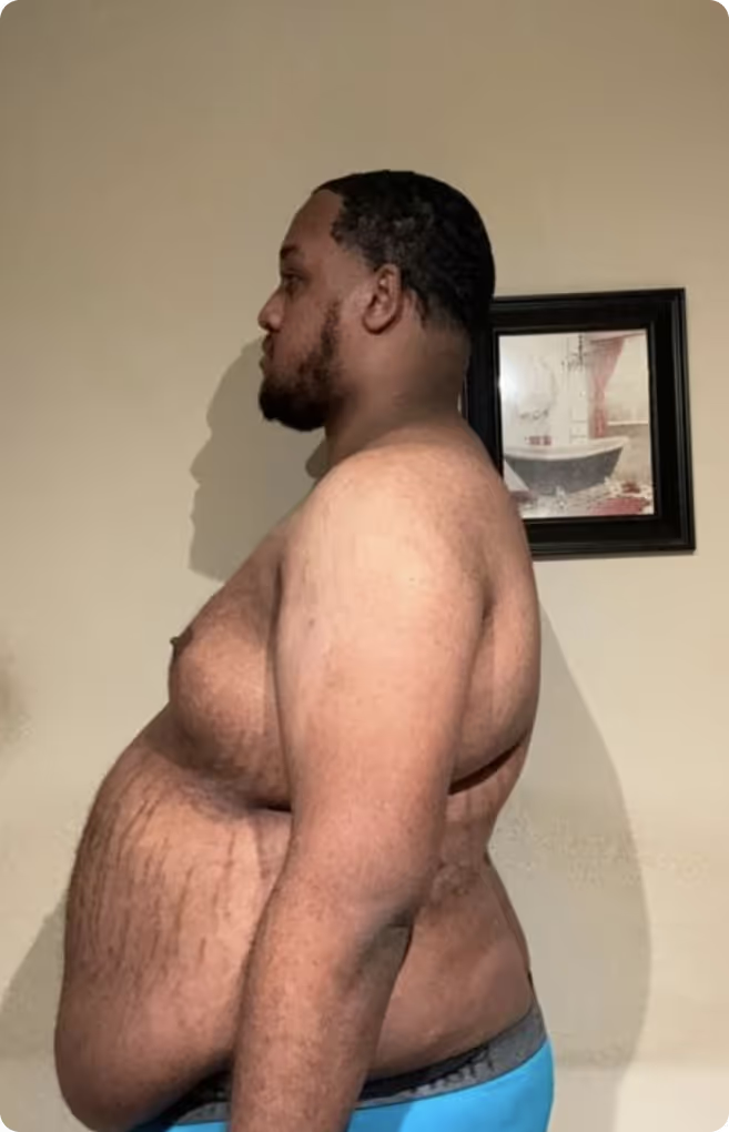 Before transformation