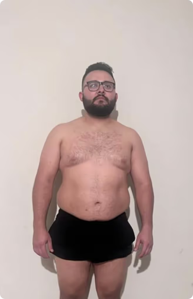Before transformation