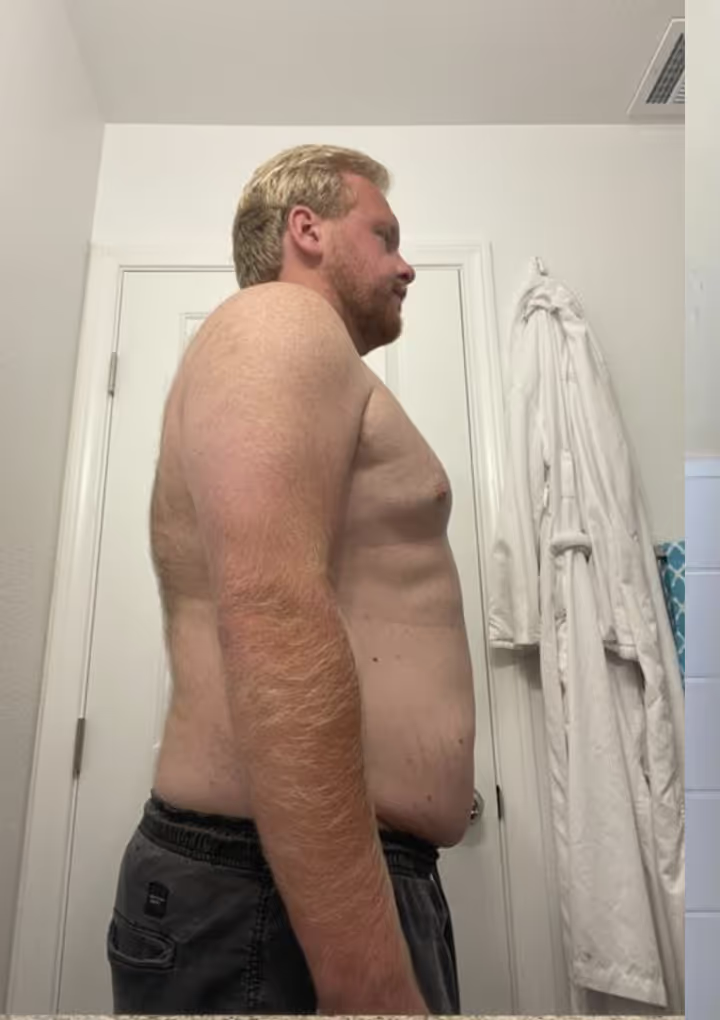 Before transformation