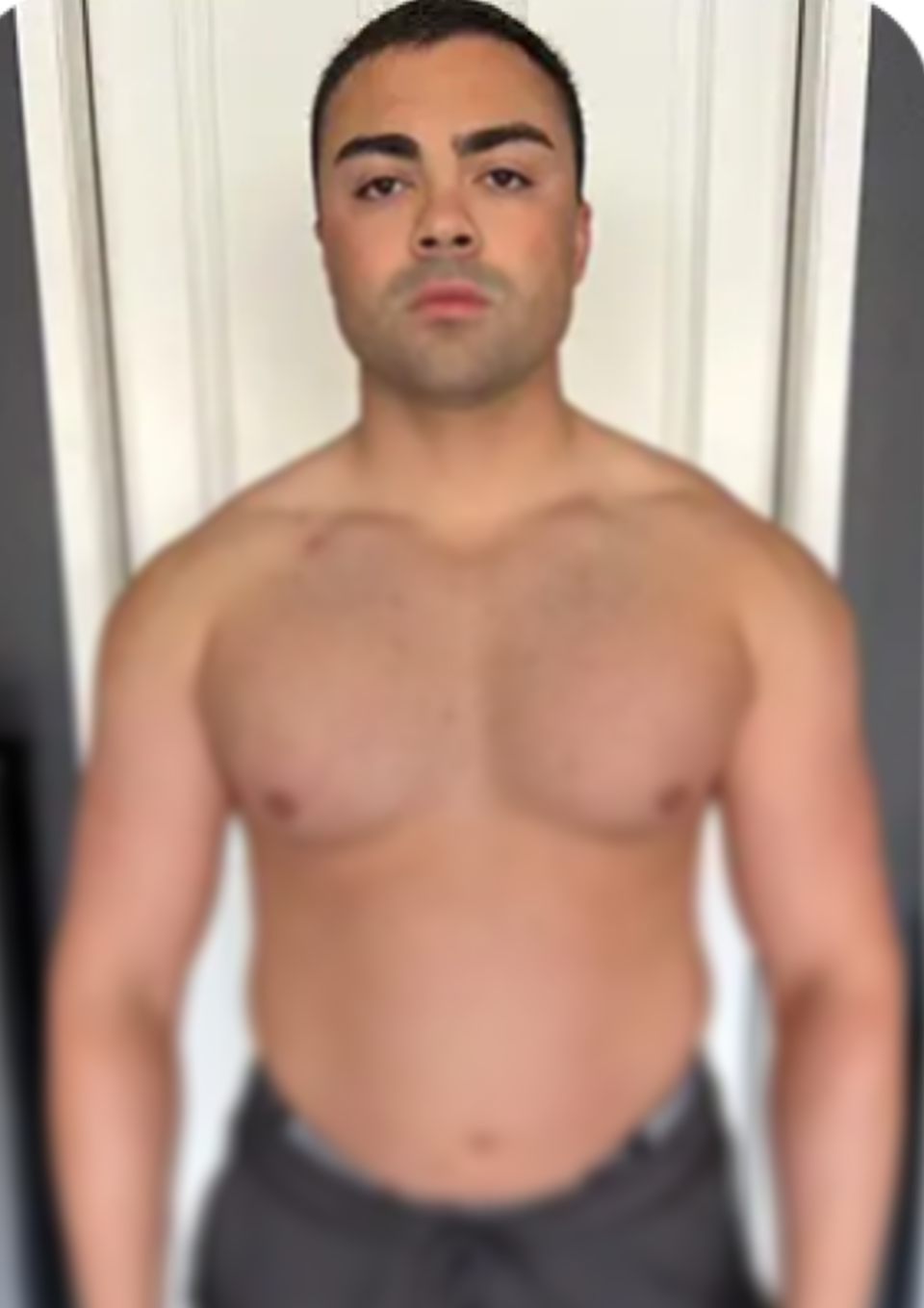 Steven S. — Before